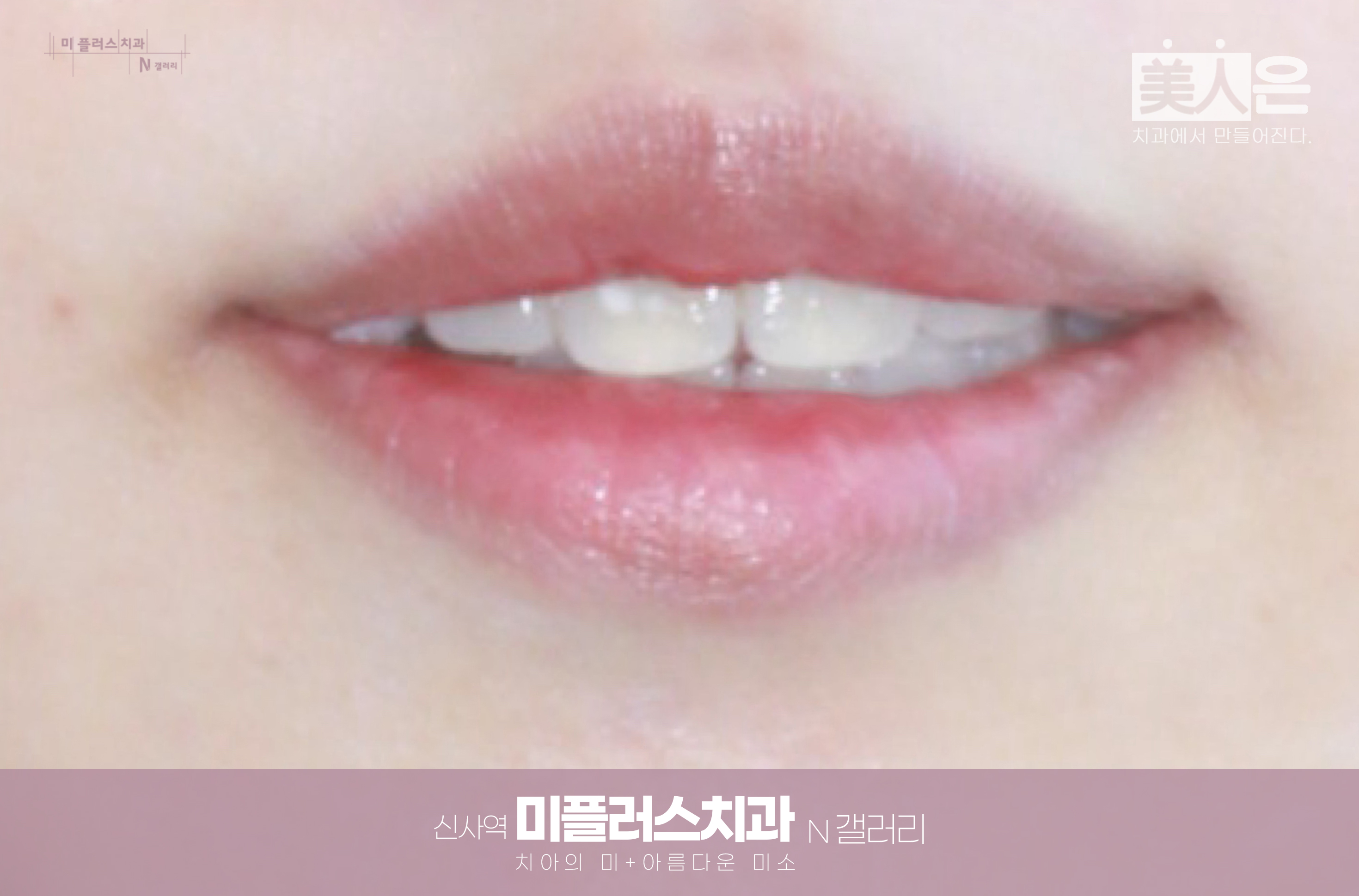 자연스럽게 올라간 입꼬리와 편안한 미소를 보여주는 입매