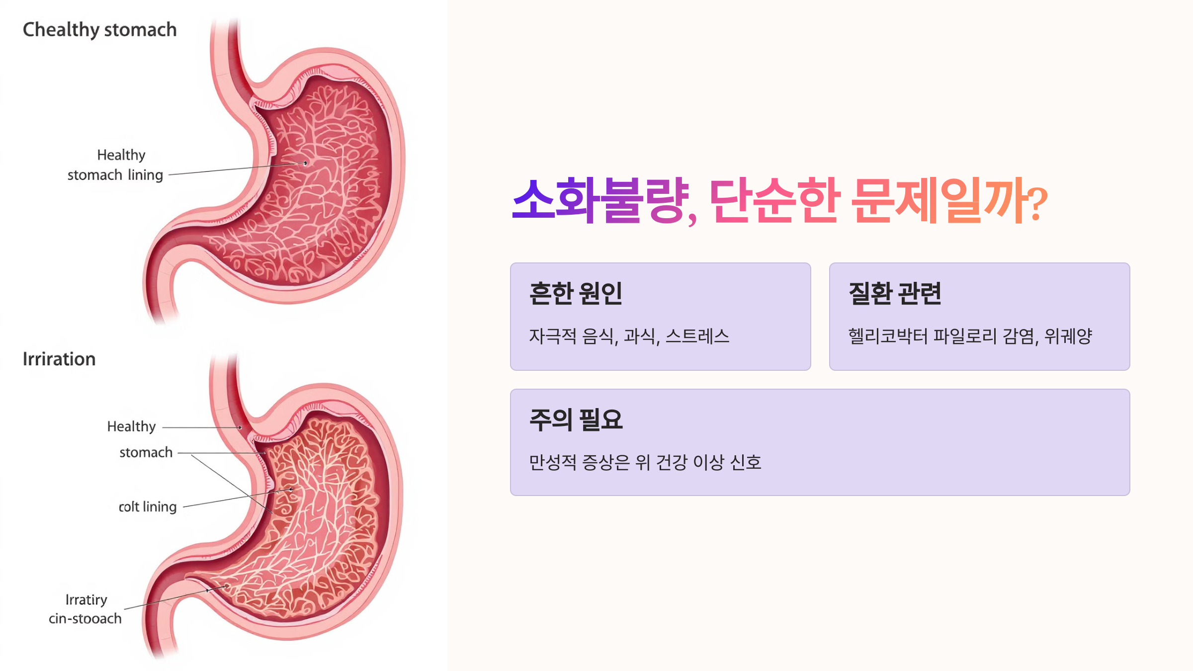 소화불량, 단순한 문제일까?