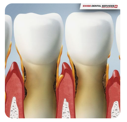 잇몸-노화-원인