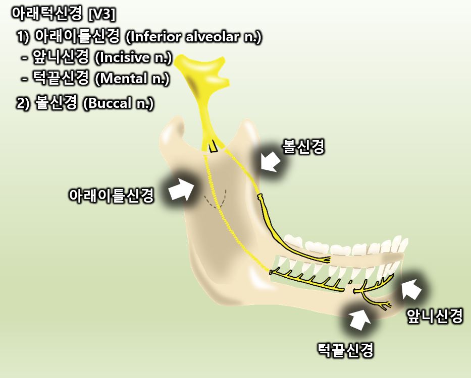 사랑니 발치 과정과 통증, 신경 손상에 대한 모든 것