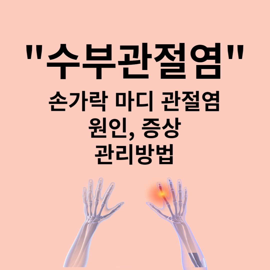 수부관절염