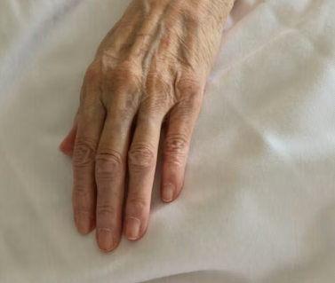 비타민A의 효능 영양제 선택