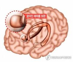 해마