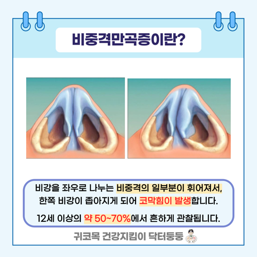 비중격 교정술 증상 및 진단 방법