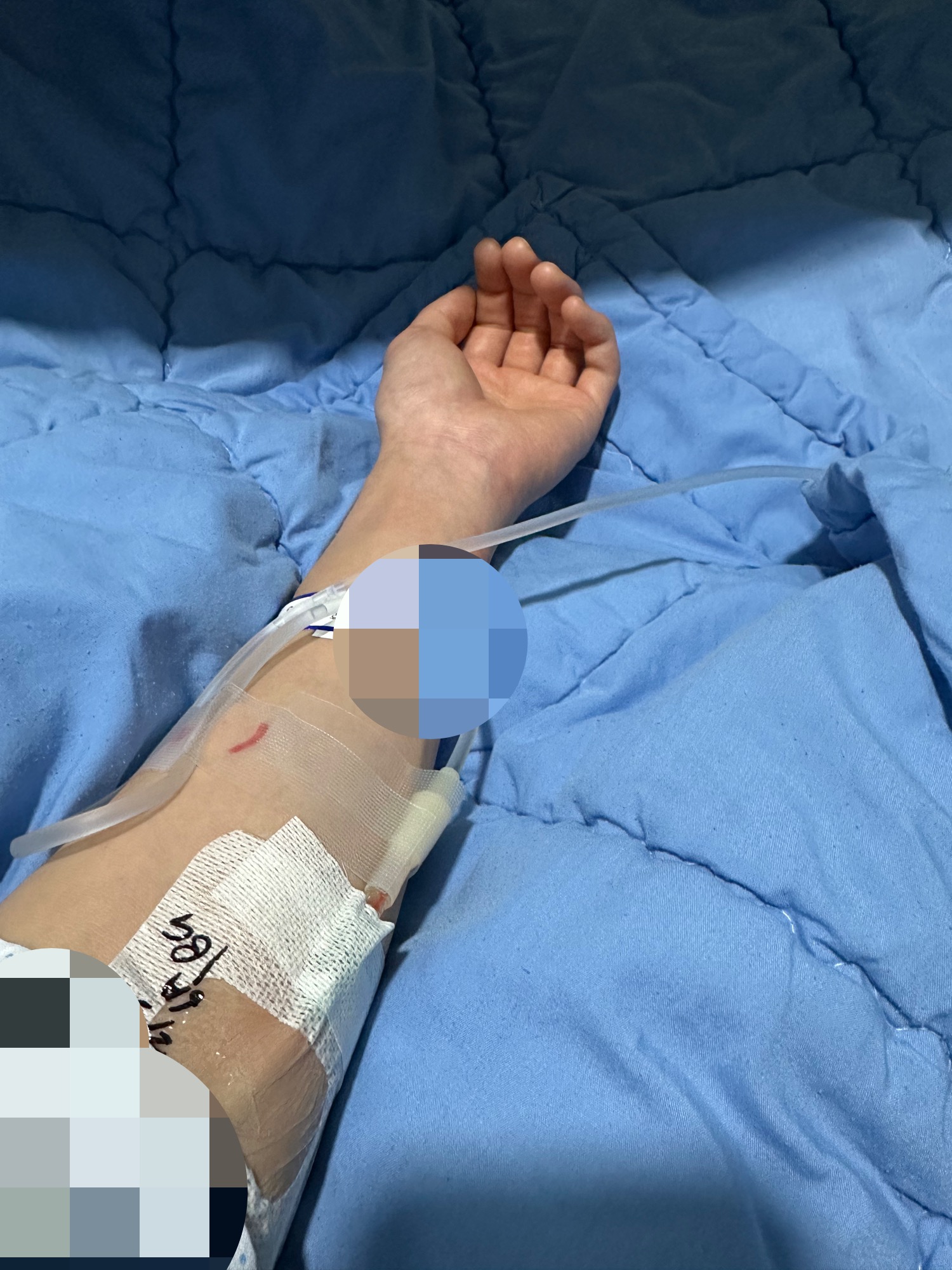 링거를-꼽은-모습