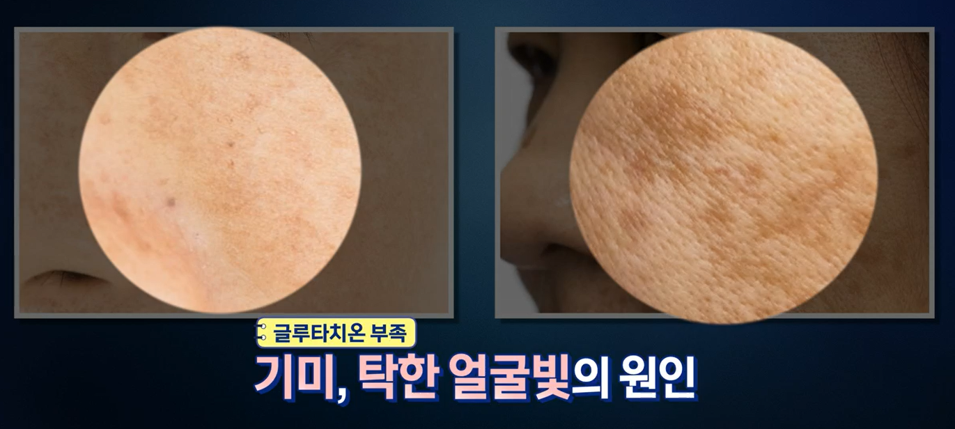 글루타치온 효능