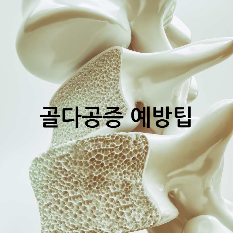 뼈튼튼운동법