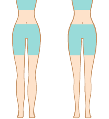 종아리 근육 통증 원인