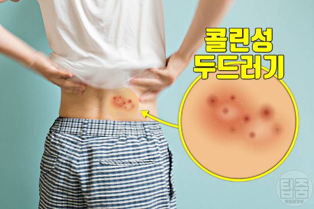 과로증상 피곤하면 두드러기 혈뇨 쌍커풀 입술물집 귀가멍멍 코피 코골이