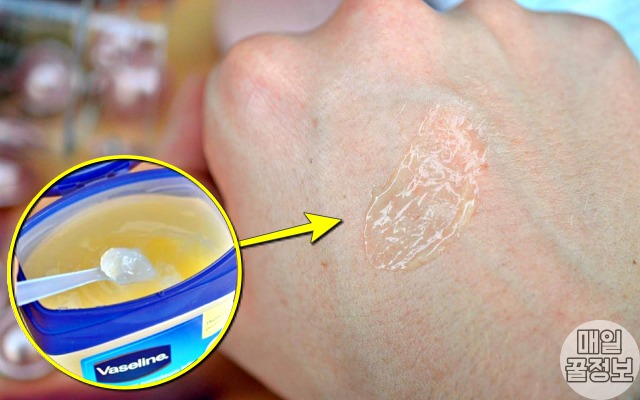 건선에 좋은 보습제 바세린 효능