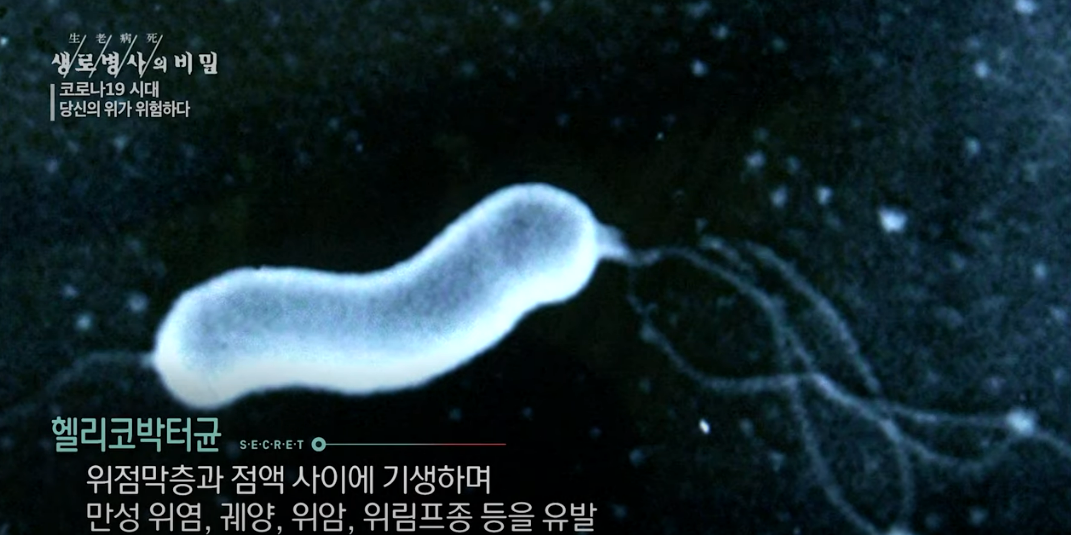 헬리코박터균 증상, 검사, 치료