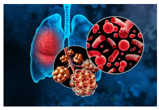 감기 몸살 빨리 낫는법5