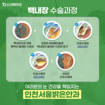 백내장 수술 비용 실비 보험 청구 회복기간_6