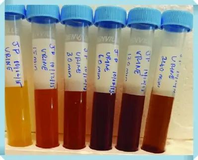 소변에 피가 섞여서 나오는 증상 혈뇨증상