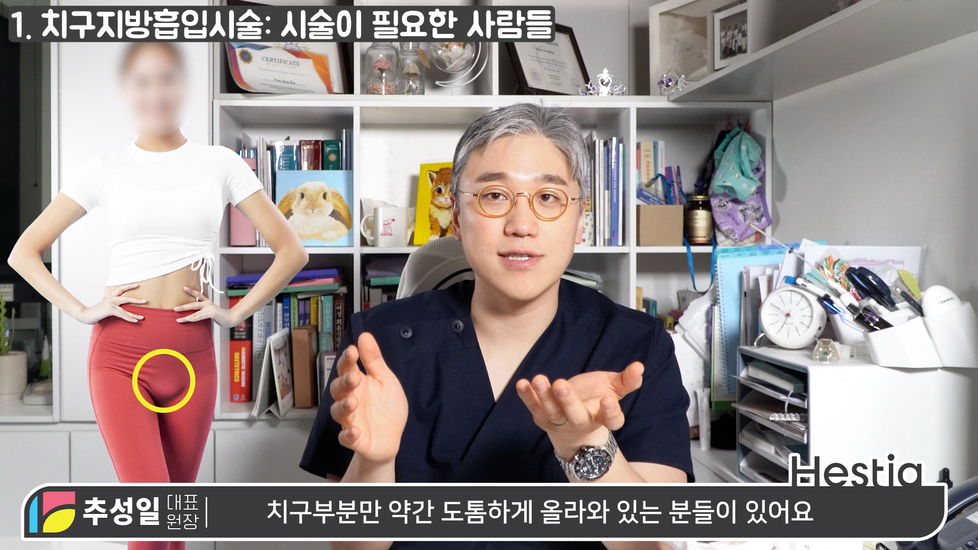 y존돌출
치구지방흡입시술