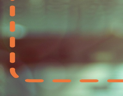 단백뇨 줄이는 방법