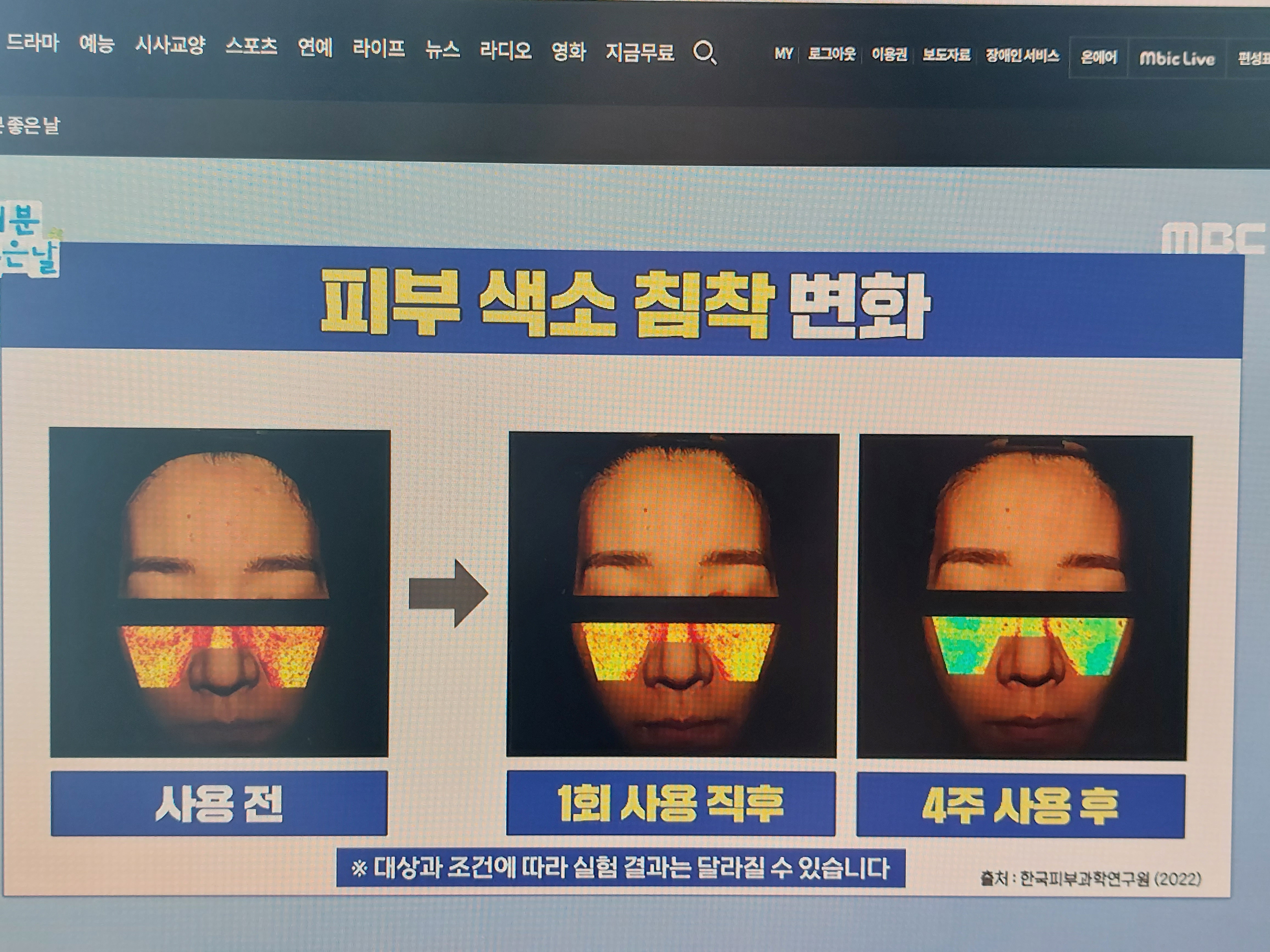 화이트 매스틱 효능