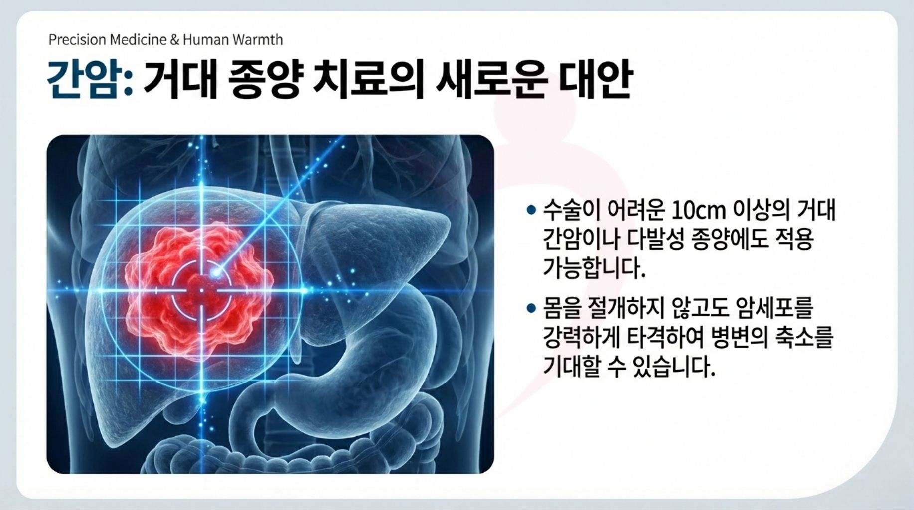 일본 중부국제의료센터 양성자치료 최신장비 ProBeam360