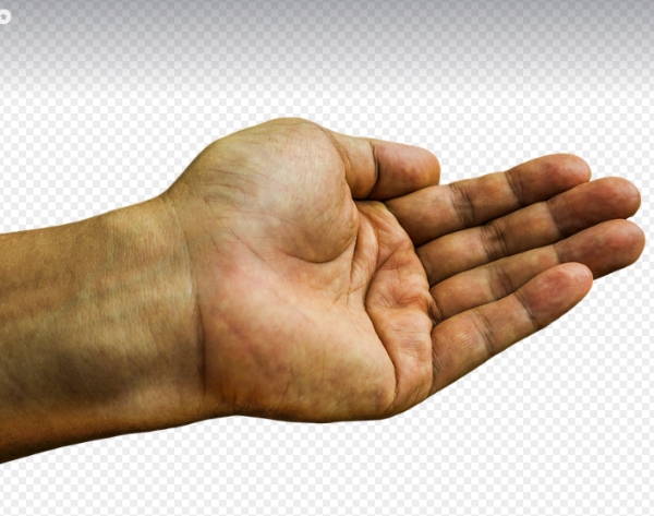 손목 터널 증후군