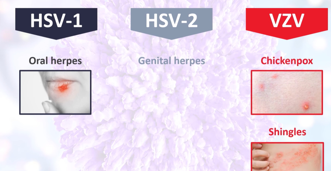 아시클로버 연고 효능