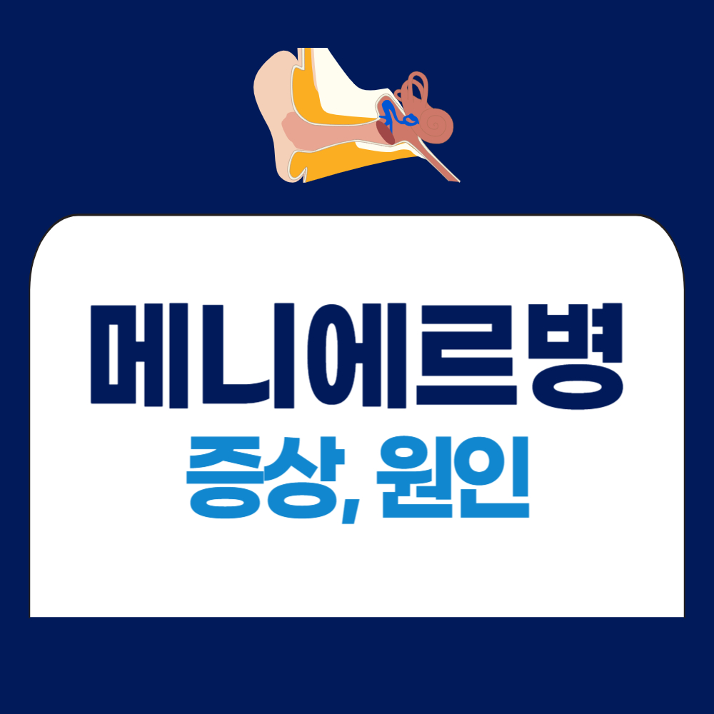 메니에르병 증상, 원인, 진단 알아보기
