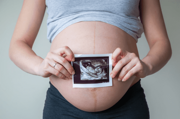 서울시 35세 이상 임산부 산전 의료비 50만원 지원 신청방법, 구비서류