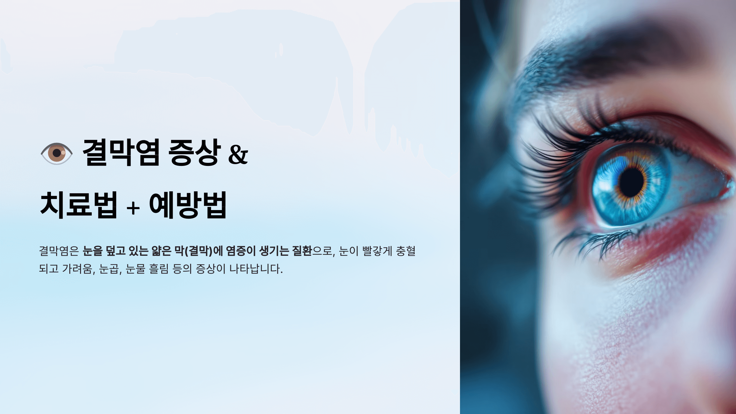 결막염과 관련된 사진입니다.