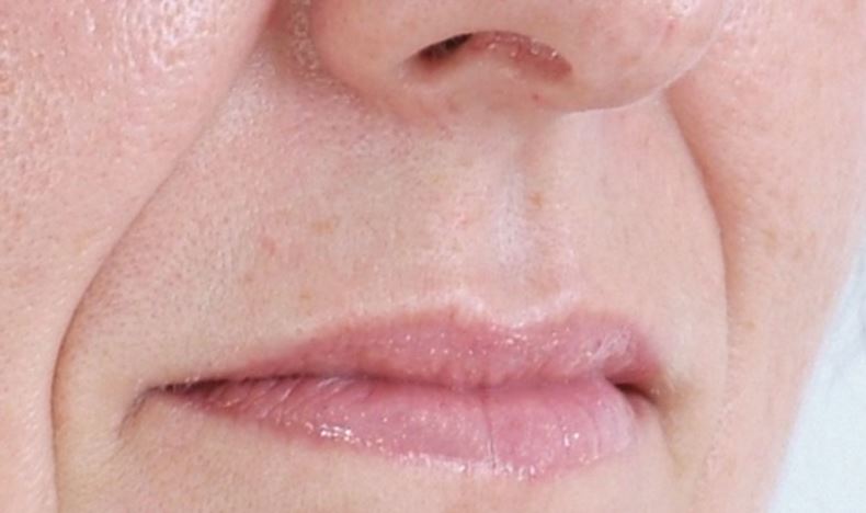 팔자주름 없애는 방법 마사지