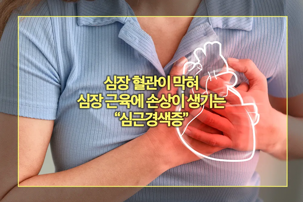 심근경색증, 심장 질환, 관상동맥 질환