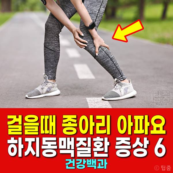 걸을때 종아리가 아파요 하지동맥질환 증상