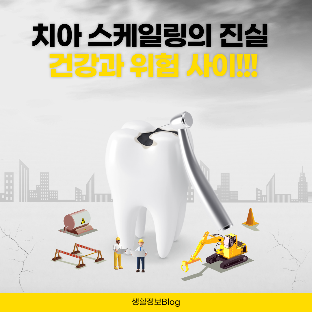 치아 스케일링이 치아에 미치는 영향에 대해 알고 계신가요? 이 글에서는 치아 스케일링의 필요성과 잠재적 위험을 탐구합니다. 구강 건강을 위한 균형 잡힌 접근법을 제공합니다