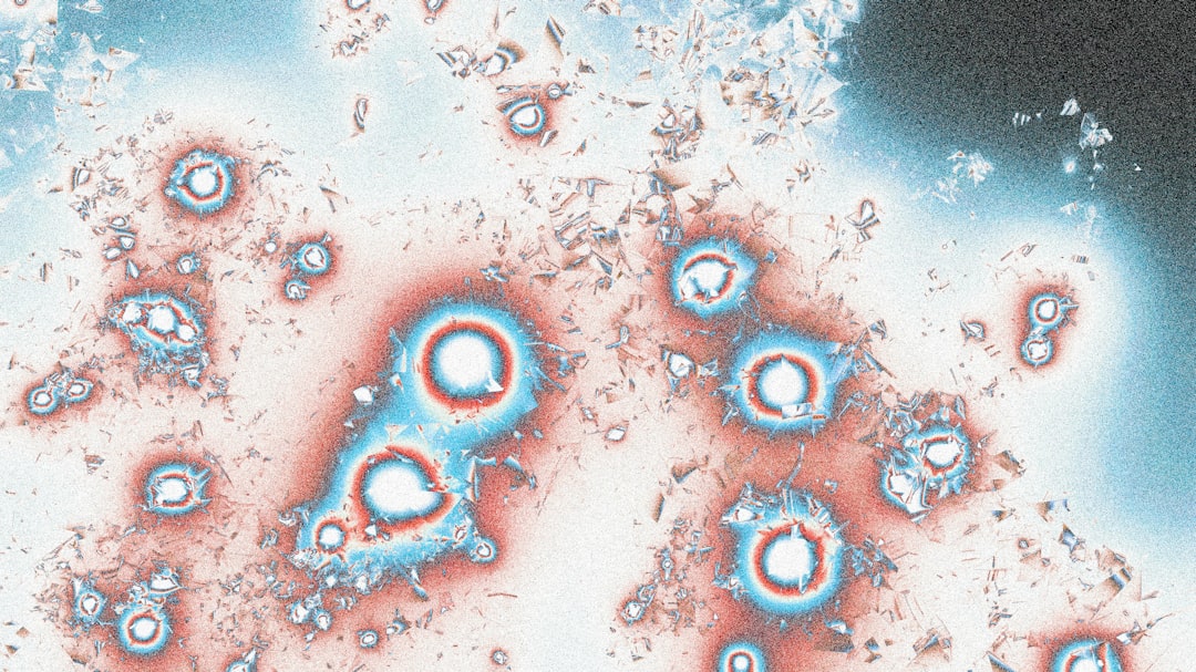 uric acid