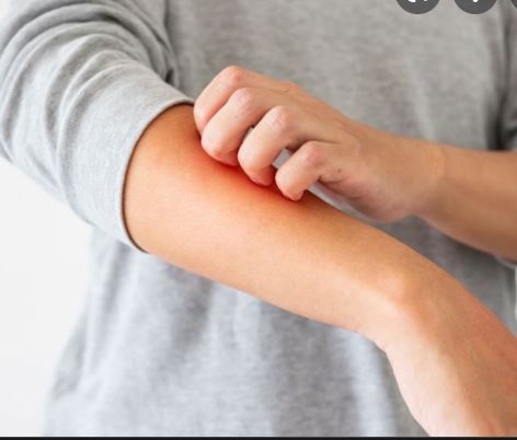 대상포진 간지러움