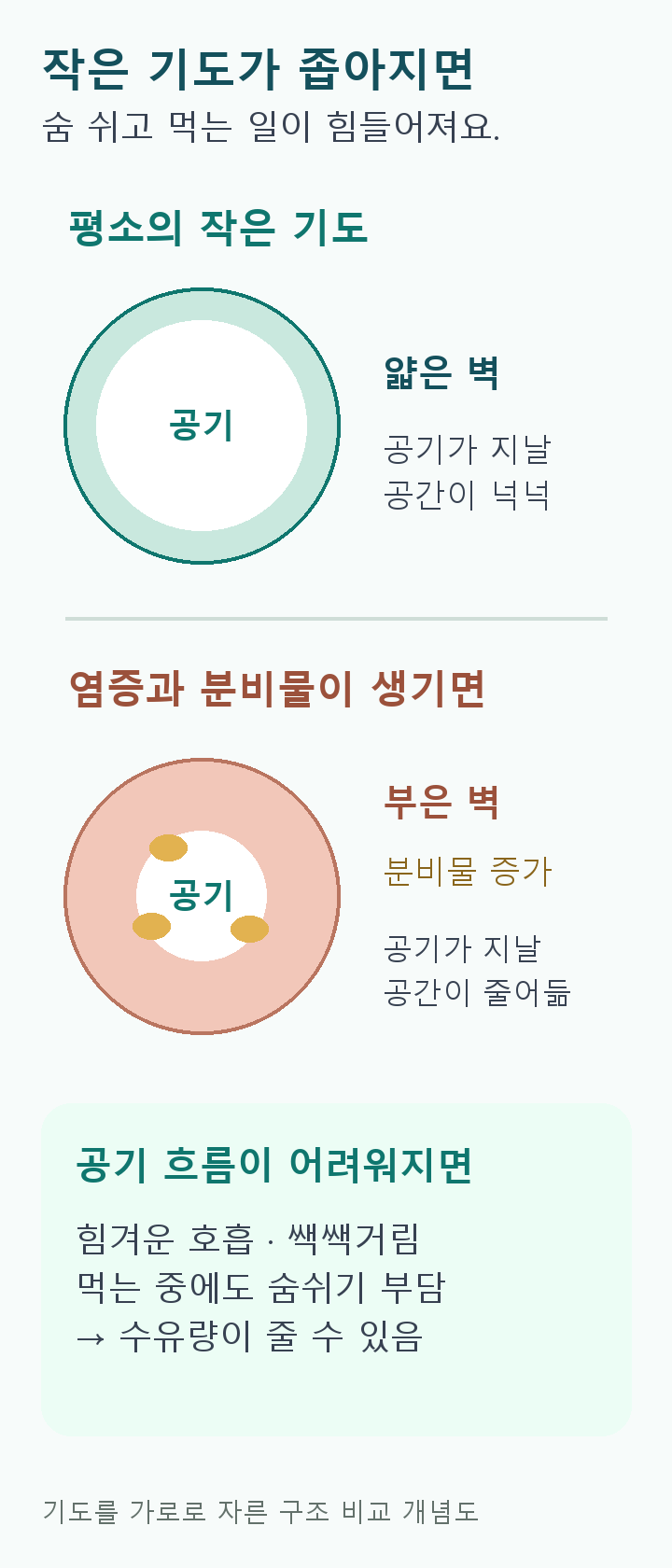 작은 기도의 단면 비교. 평소에는 얇은 벽 안쪽으로 공기가 지나며, 염증으로 벽이 붓고 분비물이 늘면 공기가 지날 공간이 줄어든다. 이 때문에 호흡과 수유가 어려워질 수 있다.