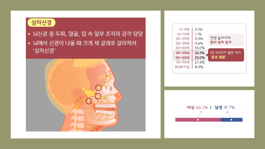 삼차-신경통