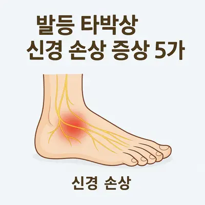 발등 타박상 신경 손상 증상 5가지: 발등 다친 후 저림, 발등 신경 손상