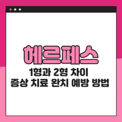 헤르페스, HSV-1, HSV-2, 구순헤르페스, 성기헤르페스, 항바이러스제, 면역력, 예방, 치료, 건강관리