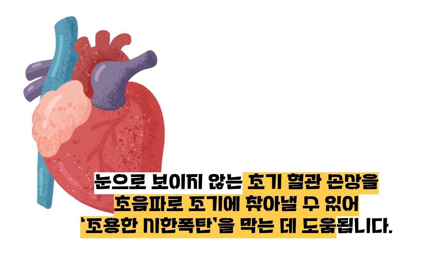 경동맥 두께 정상수치