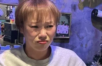 입짧은햇님 주사이모 논란