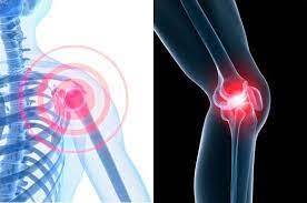 관절 영양제 추천 순위 (내돈내산 솔직후기)