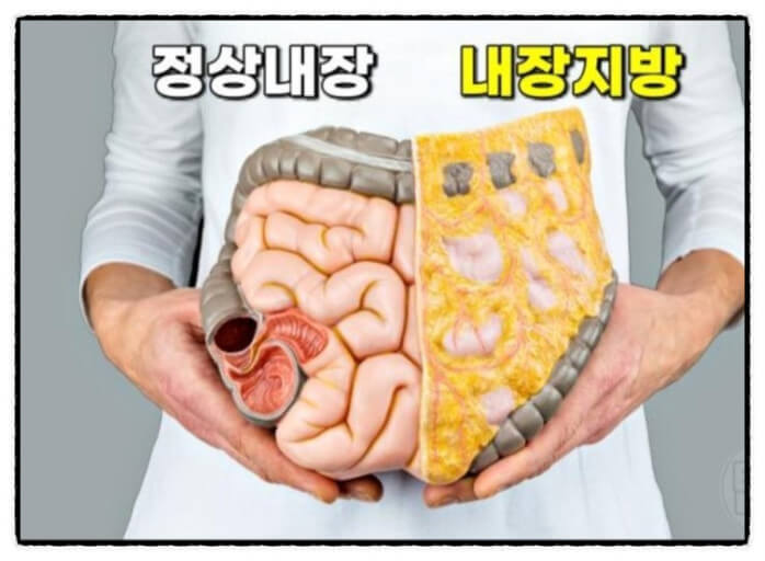내장지방 개념도