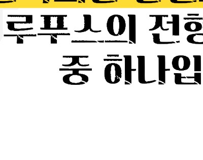 루푸스병 이란