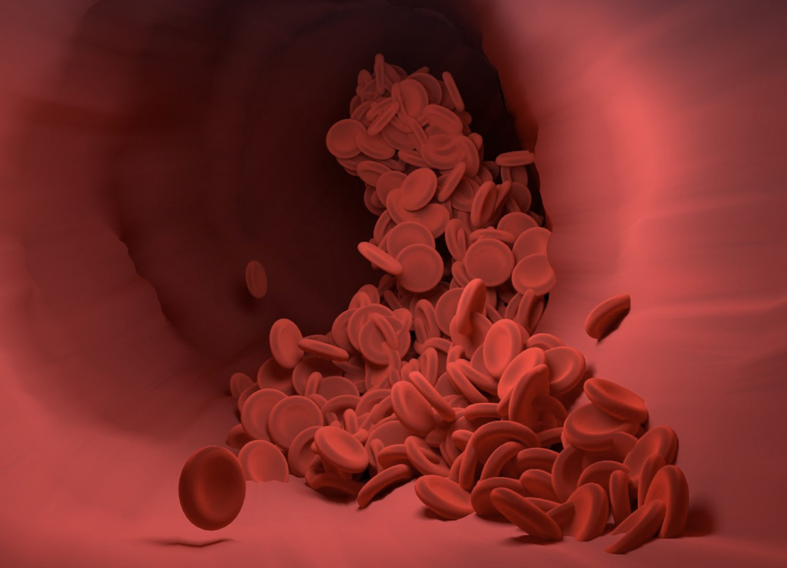 혈관 관련 사진