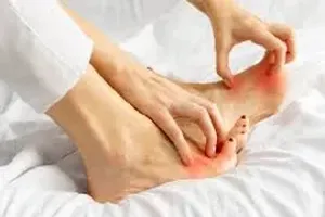 가려움