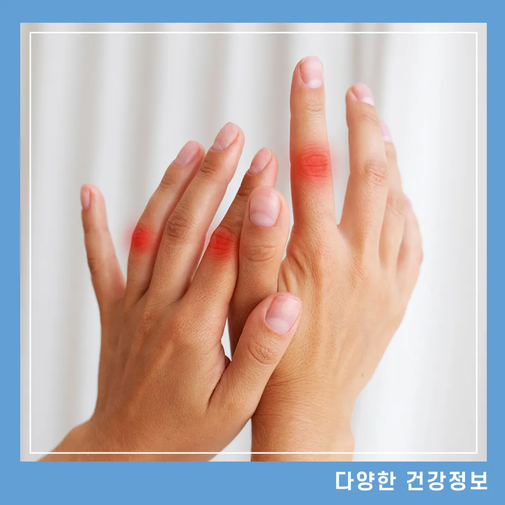 손가락 마디 통증 붓는 원인
