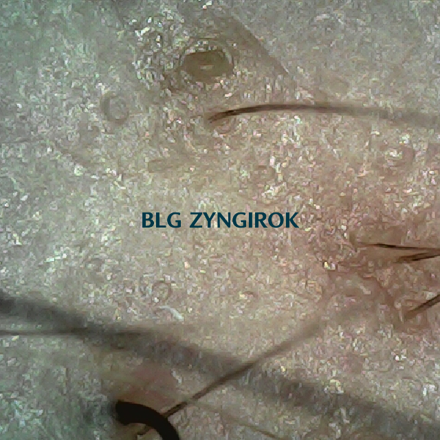 탈모 극복 프로젝트 - 오른쪽 M자 부위 두피모습이다.