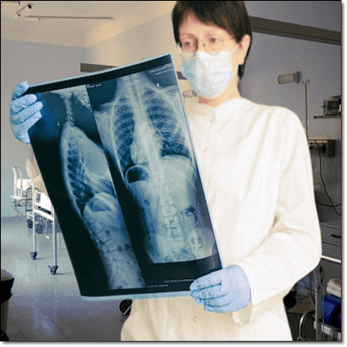 기관지 확장증 검진