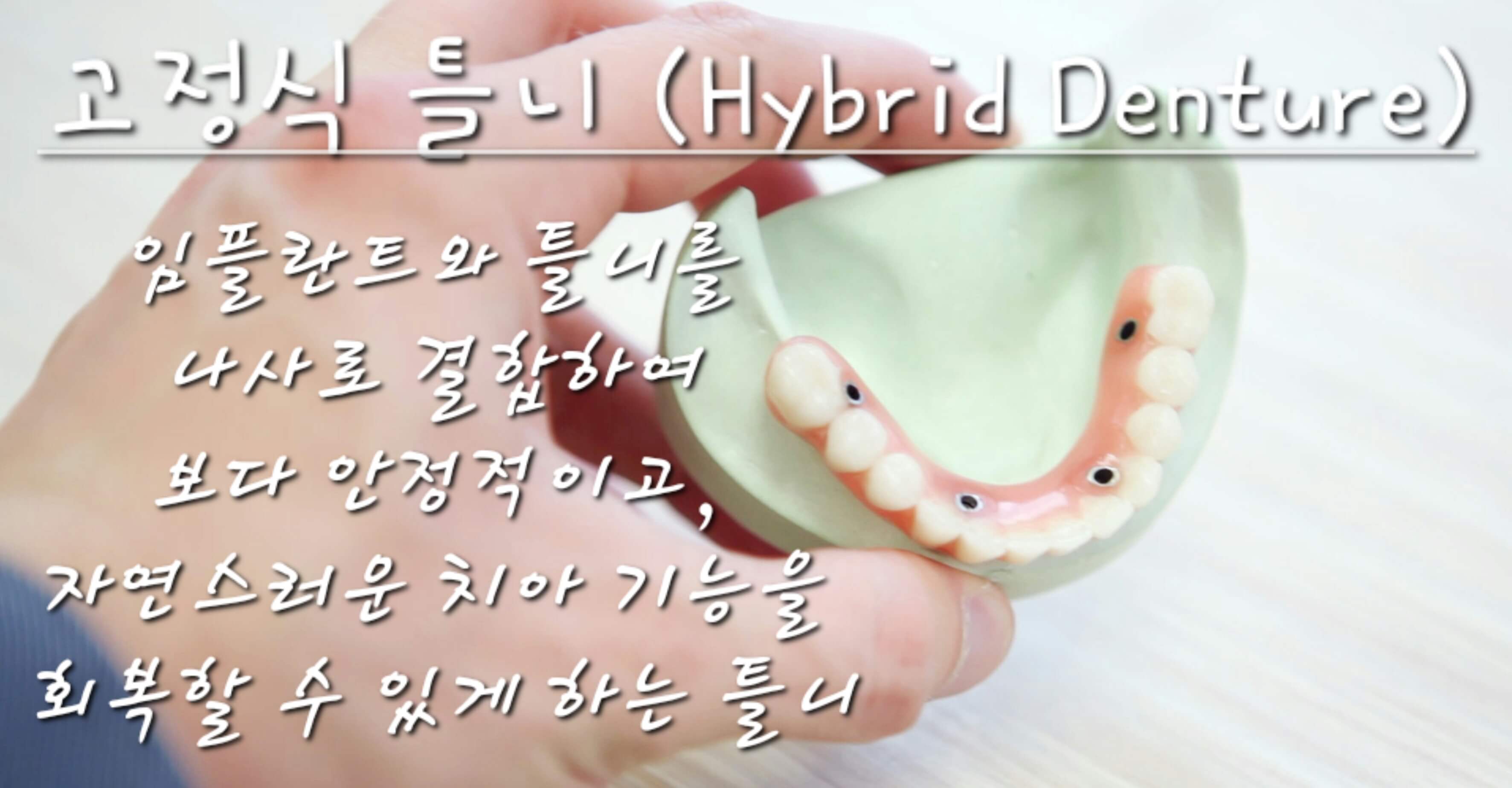 하이브리드 덴쳐