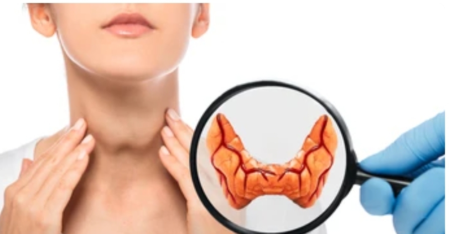 갑상선 기능 저하증