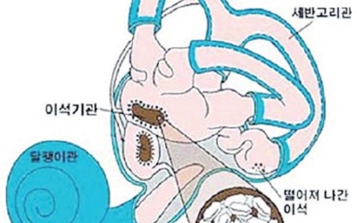 어지럼증의 원인 이미지